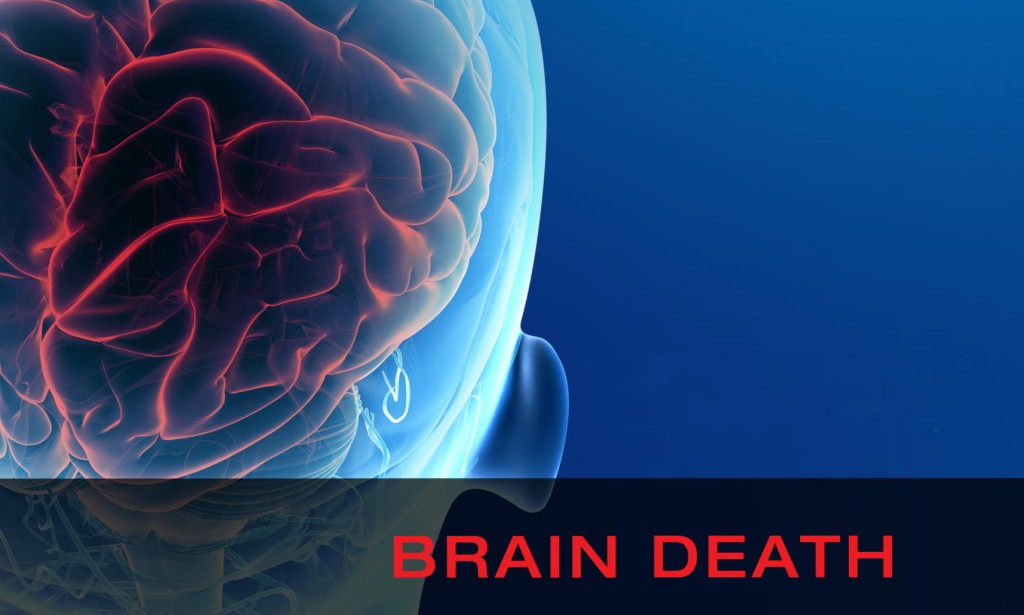 What is Brain Death