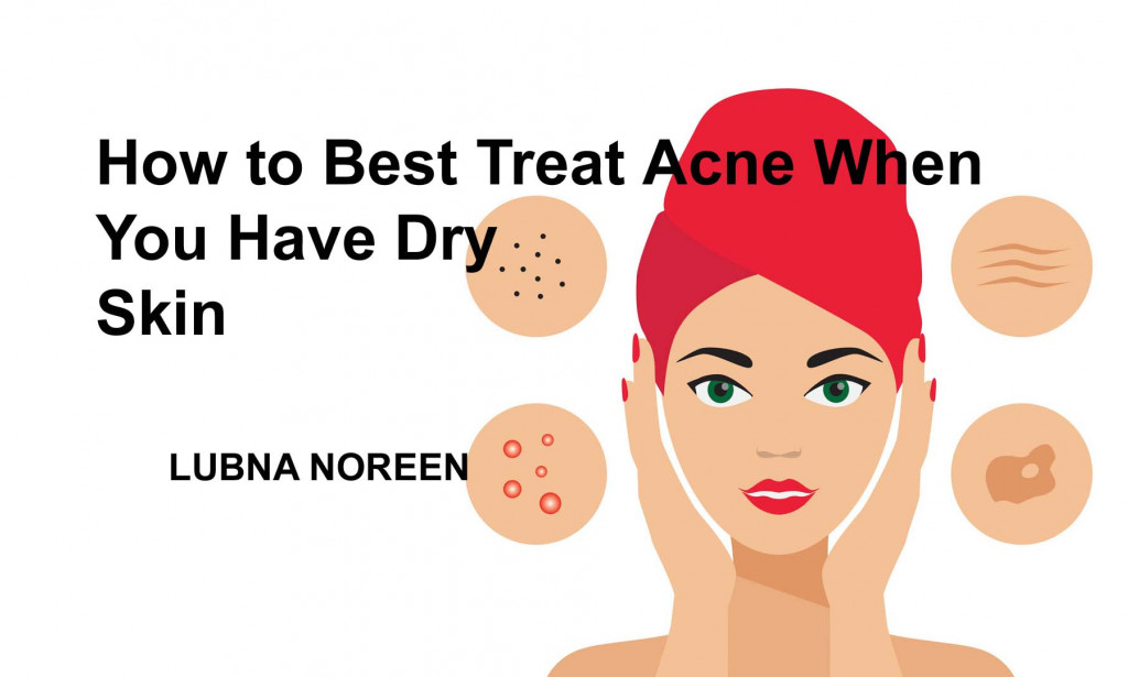 How To Best Treat Acne When You Have Dry Skin