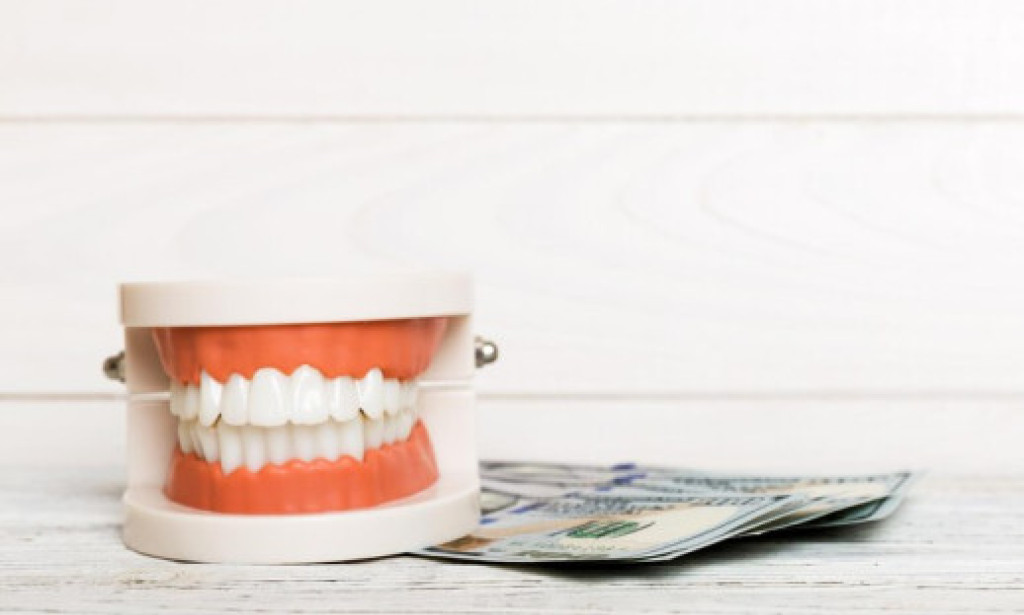 Top Factors That Influence the Cost of Dental Implants